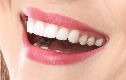 Image of Woman with healthy and white teeth, closeup