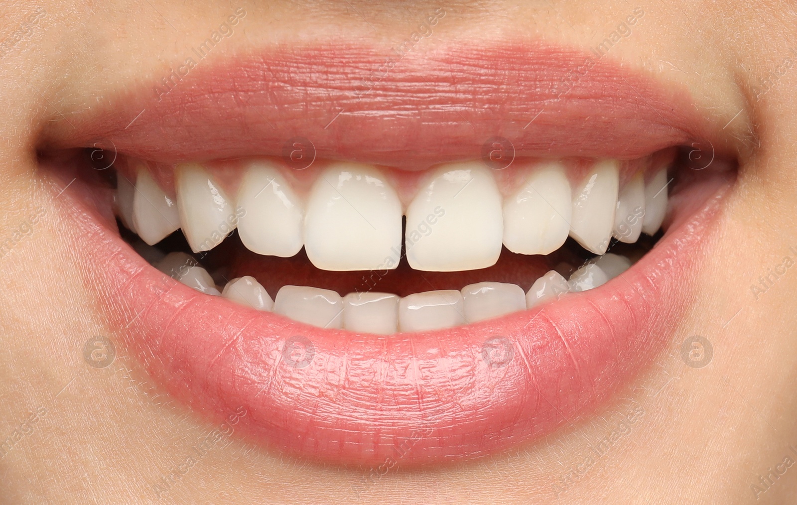 Image of Young woman with healthy teeth and beautiful smile, closeup