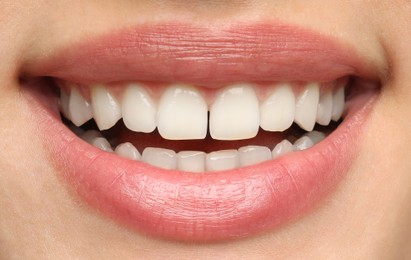 Young woman with healthy teeth and beautiful smile, closeup