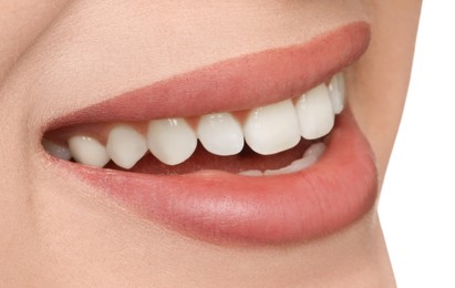 Young woman with healthy teeth and beautiful smile, closeup