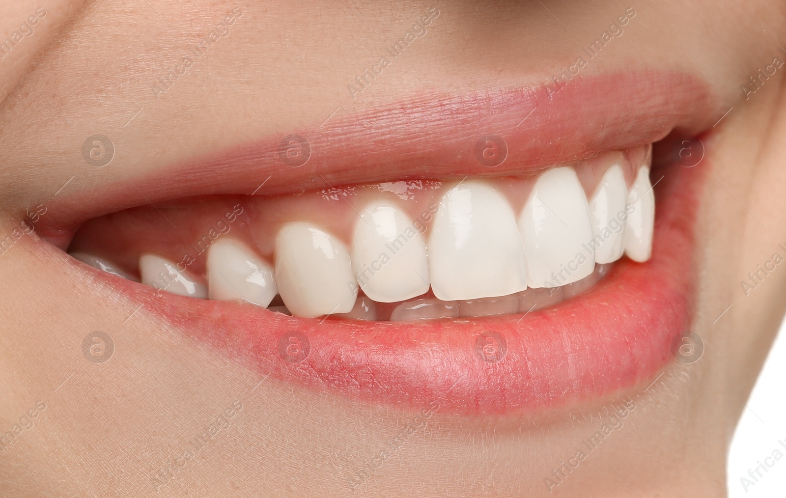 Image of Young woman with healthy teeth and beautiful smile, closeup