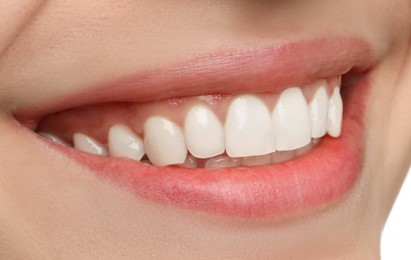 Image of Young woman with healthy teeth and beautiful smile, closeup