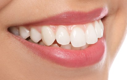 Young woman with healthy teeth and beautiful smile, closeup