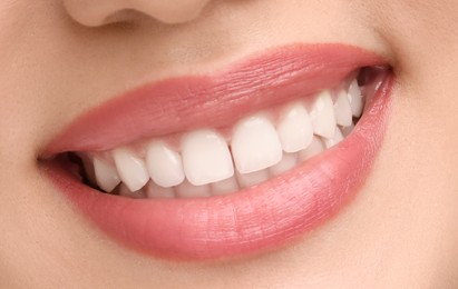 Image of Young woman with healthy teeth and beautiful smile, closeup