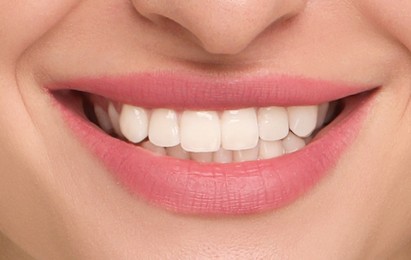 Image of Young woman with healthy teeth and beautiful smile, closeup