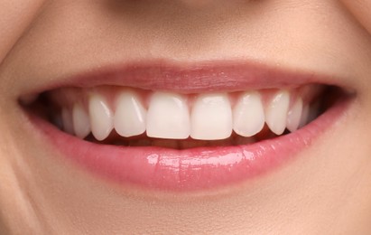 Young woman with healthy teeth and beautiful smile, closeup