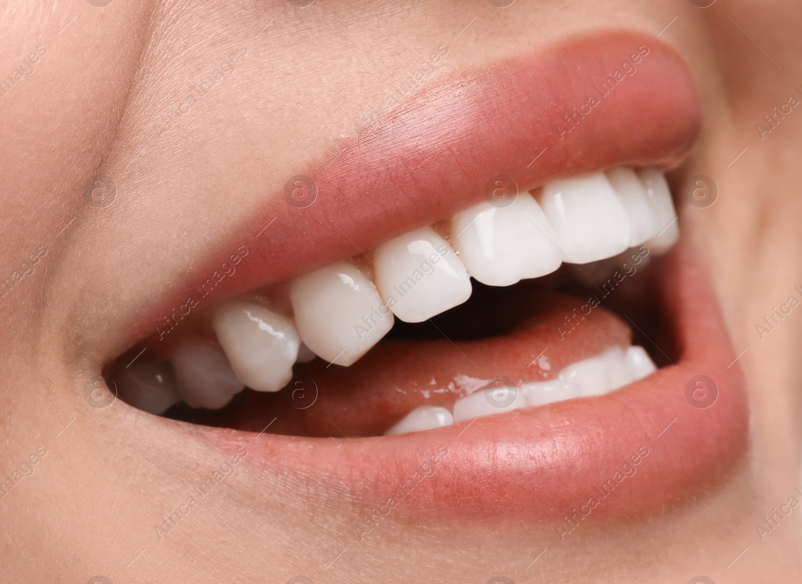 Image of Young woman with healthy teeth and beautiful smile, closeup