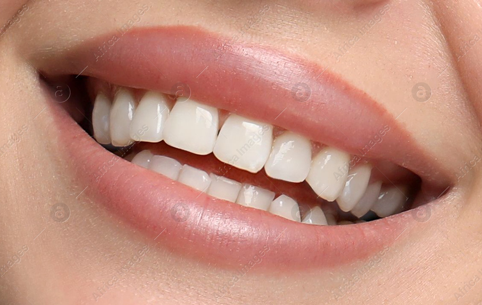 Image of Young woman with healthy teeth and beautiful smile, closeup