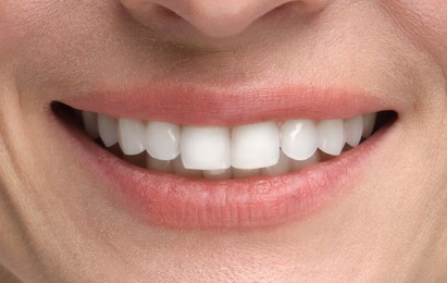 Image of Woman with healthy and white teeth, closeup