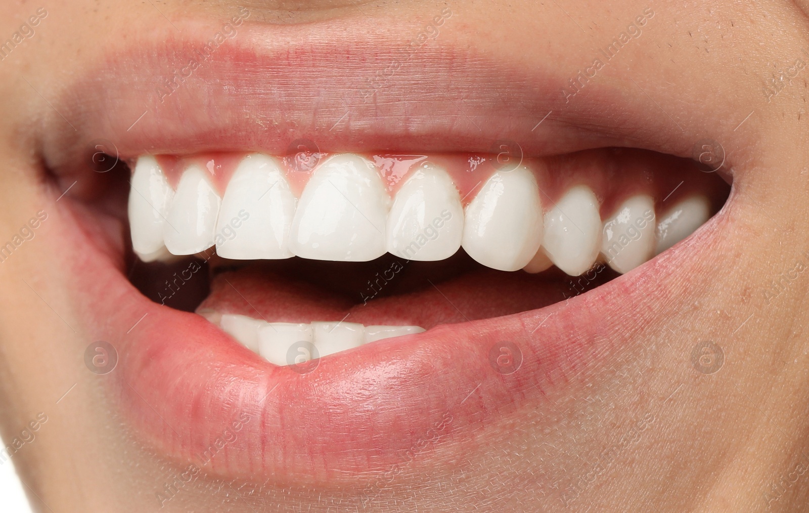 Image of Young man with healthy and white teeth, closeup