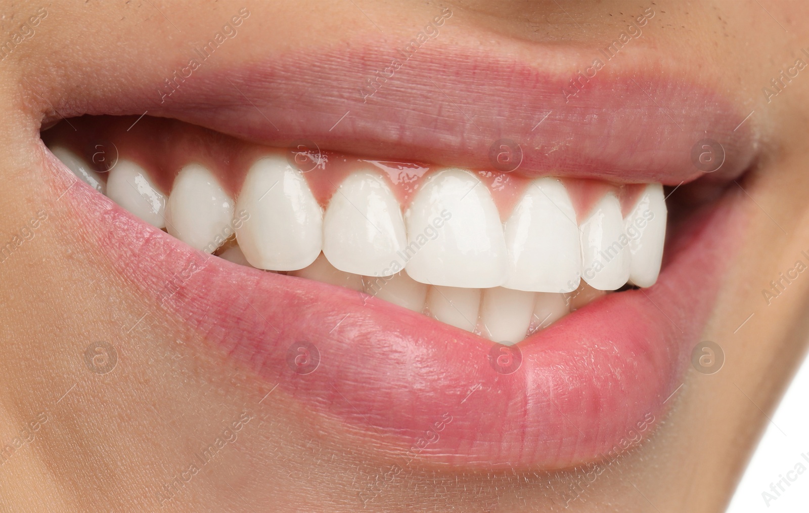 Image of Young man with healthy and white teeth, closeup