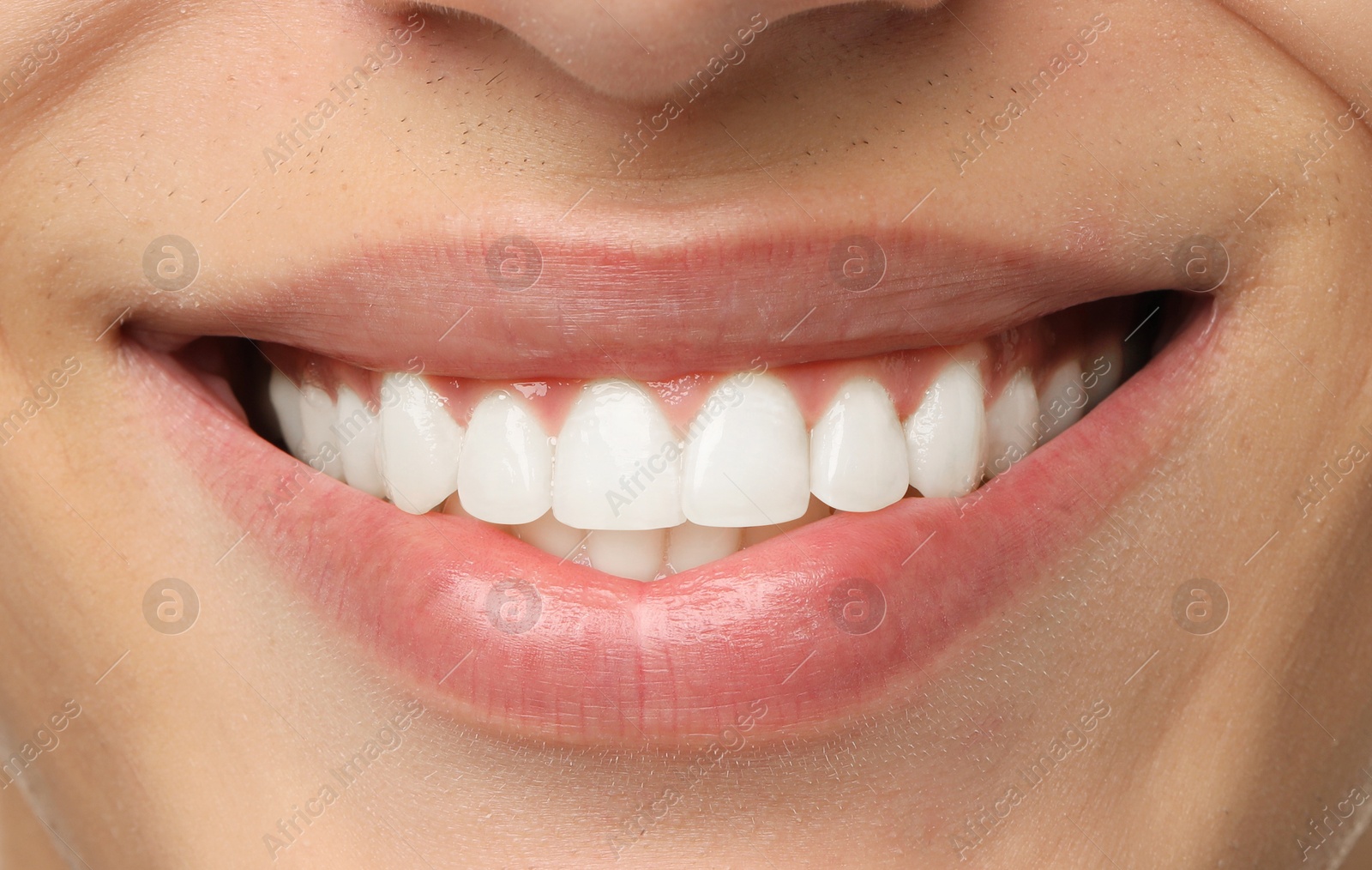 Image of Young man with healthy and white teeth, closeup