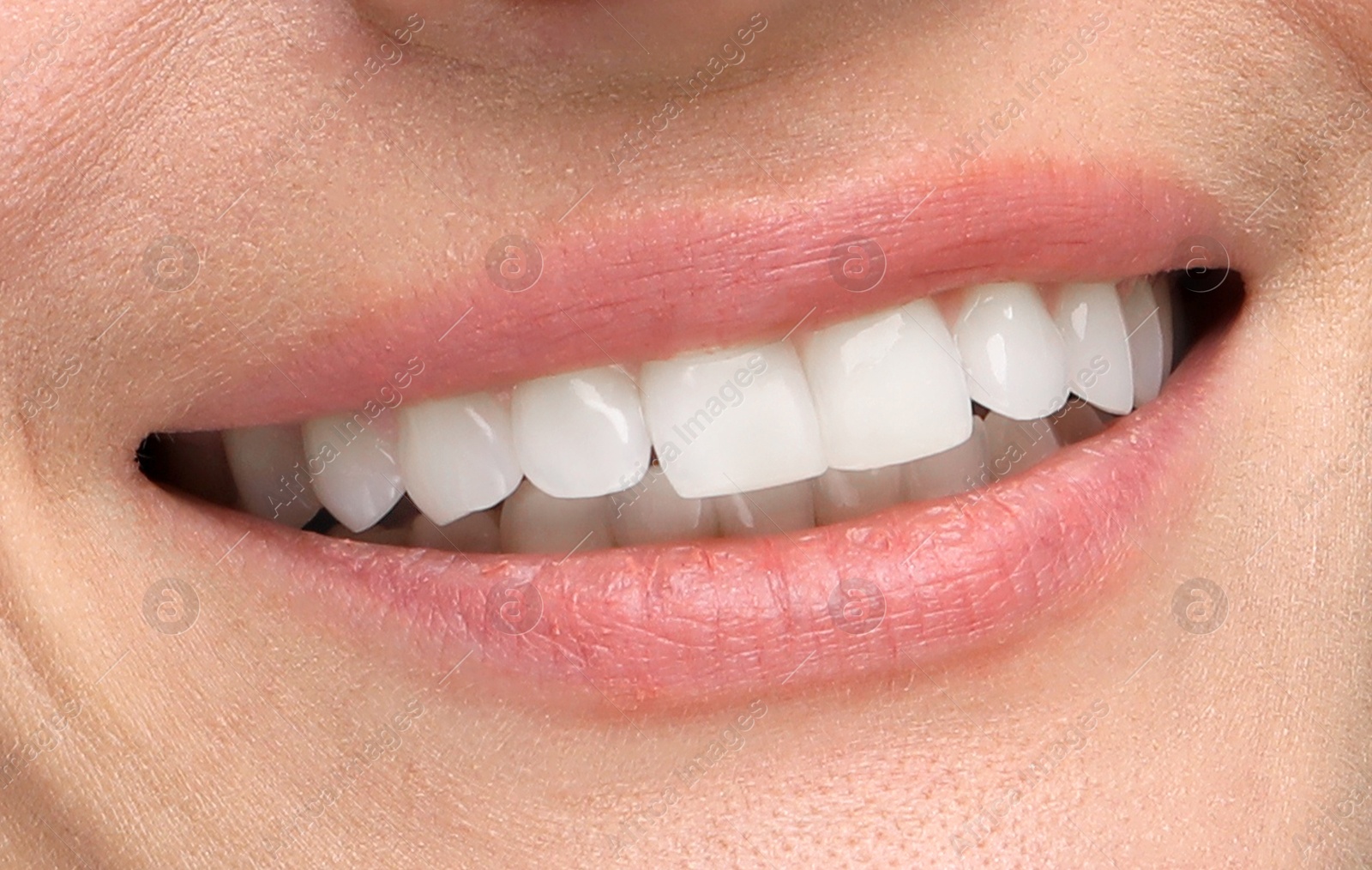 Image of Woman with healthy and white teeth, closeup