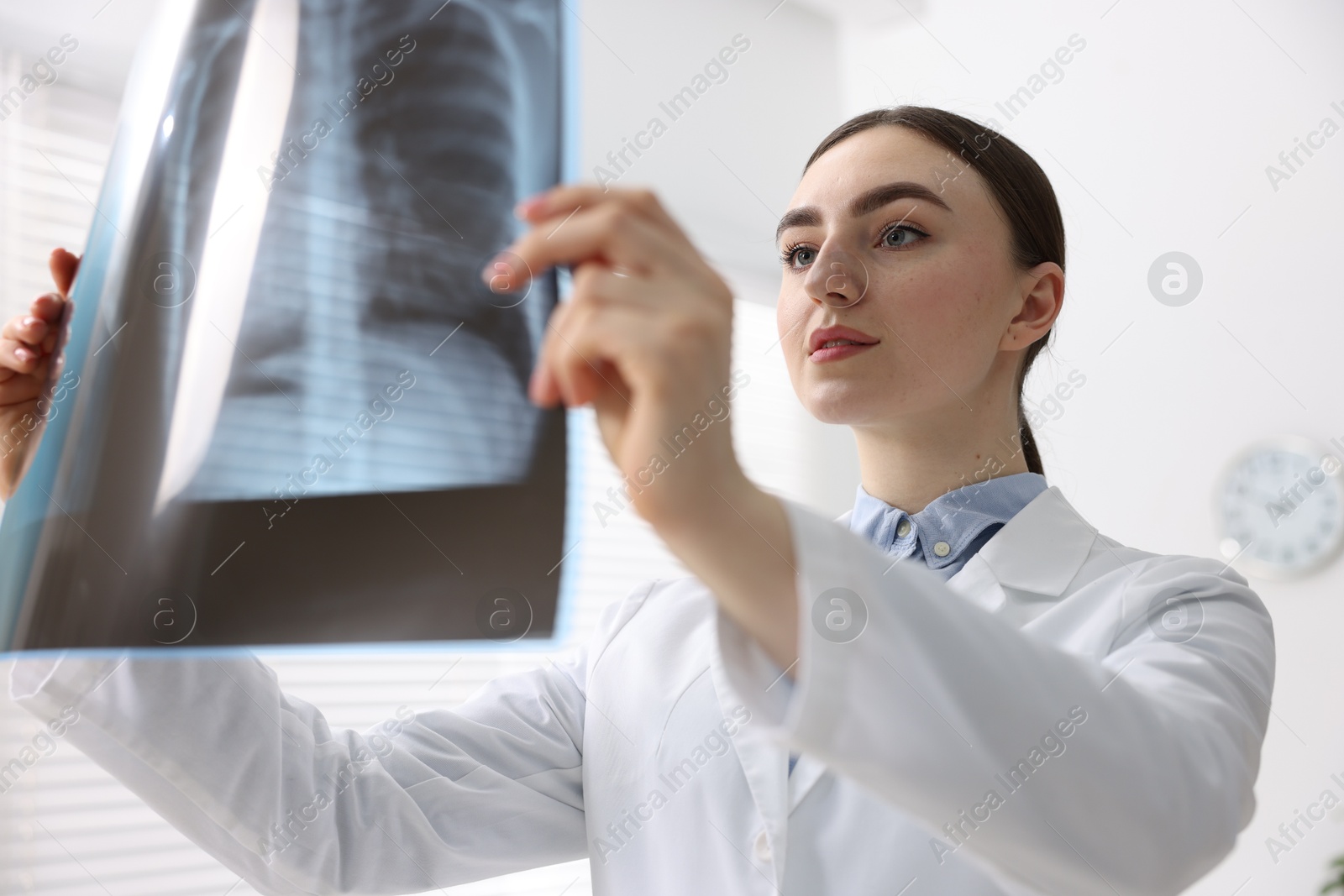 Photo of Doctor examining x-ray of lungs in hospital