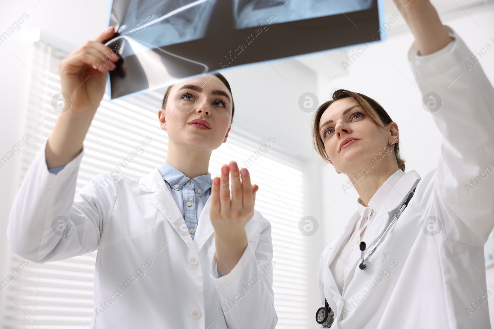 Photo of Doctors examining lungs x-ray in hospital, low angle view