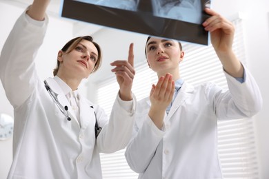 Photo of Doctors examining lungs x-ray in hospital, low angle view