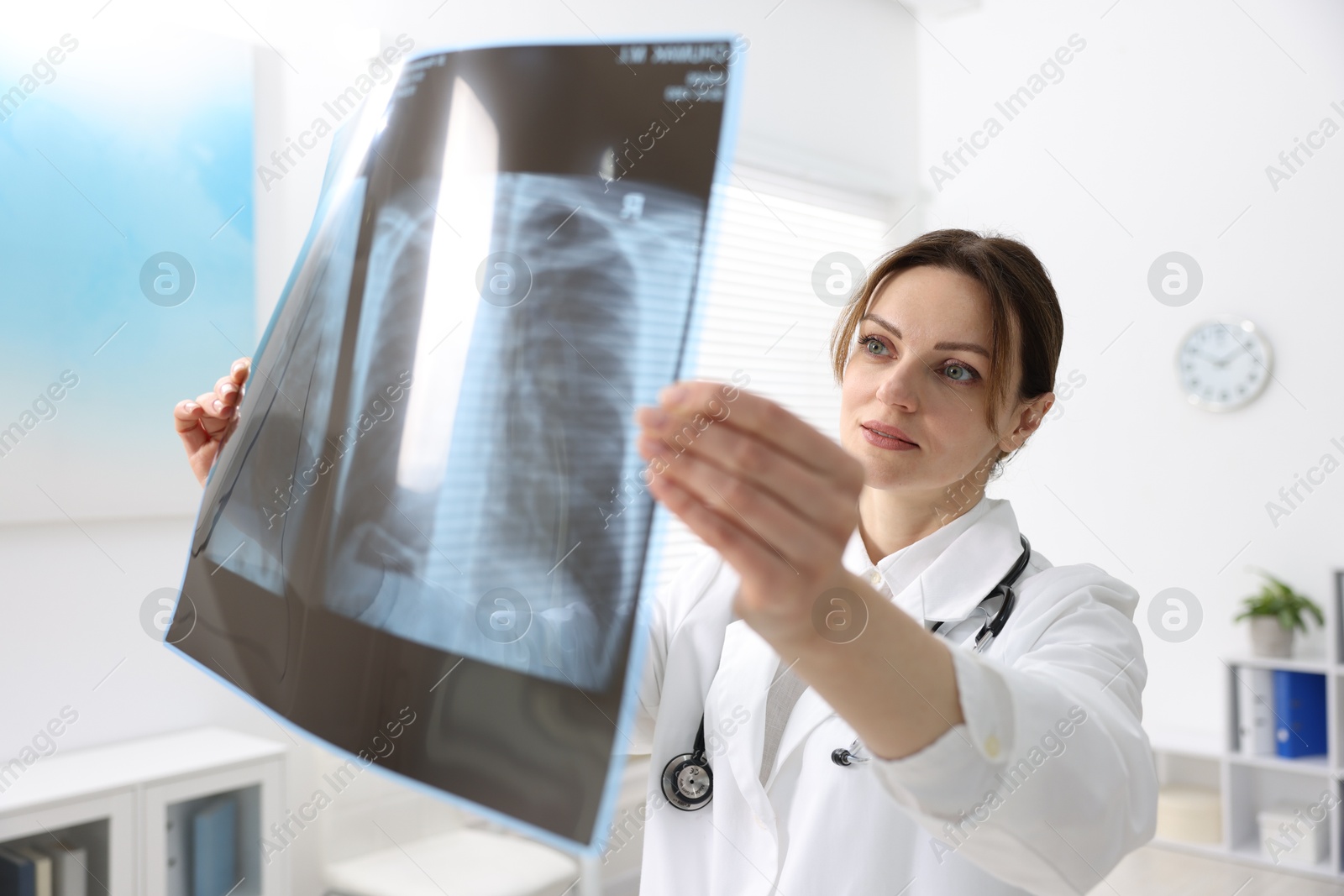 Photo of Doctor examining x-ray of lungs in hospital