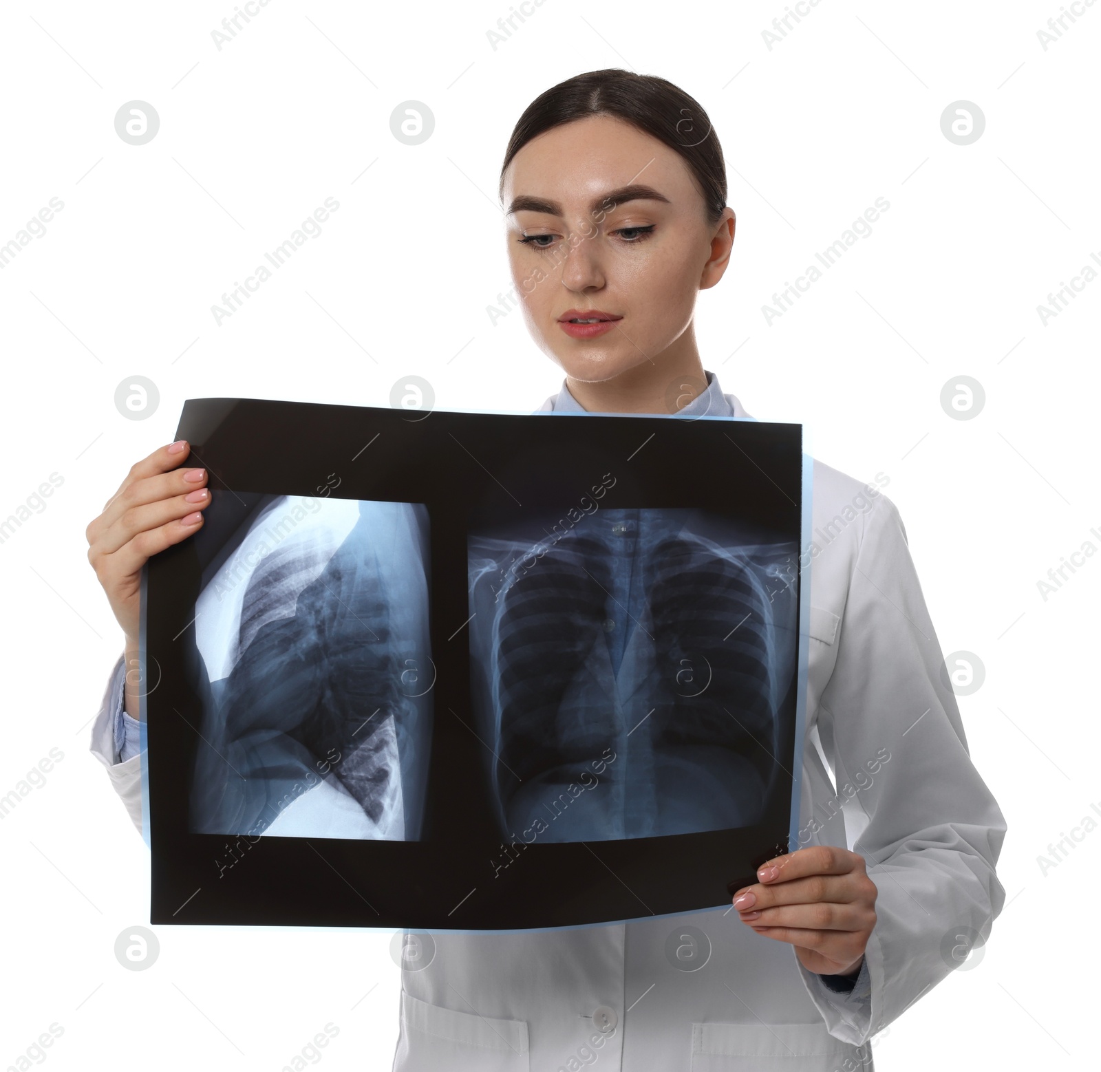 Photo of Doctor examining lungs x-ray on white background