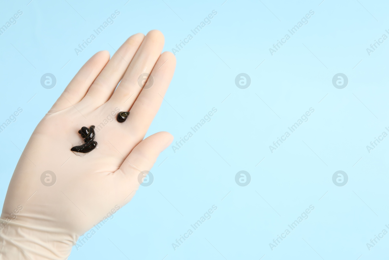 Photo of Woman holding medicinal leeches on light blue background, closeup. Space for text