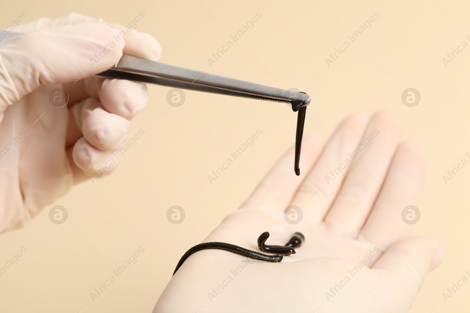 Photo of Woman holding medicinal leech with tweezers on pale yellow background, closeup