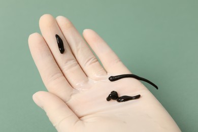 Photo of Woman holding medicinal leeches on green background, closeup