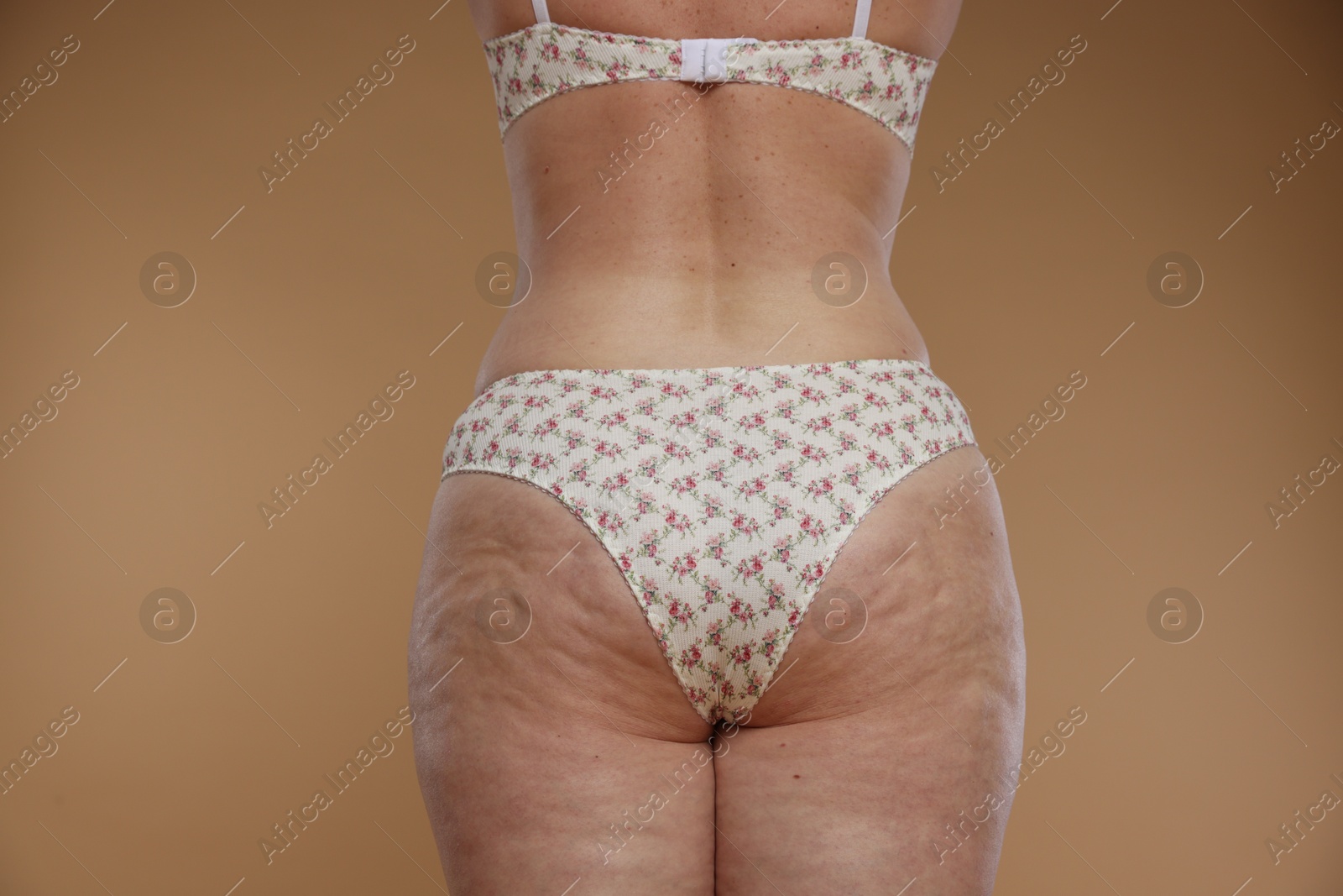 Photo of Woman with cellulite on dark beige background, closeup