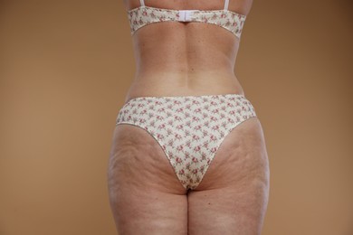 Photo of Woman with cellulite on dark beige background, closeup