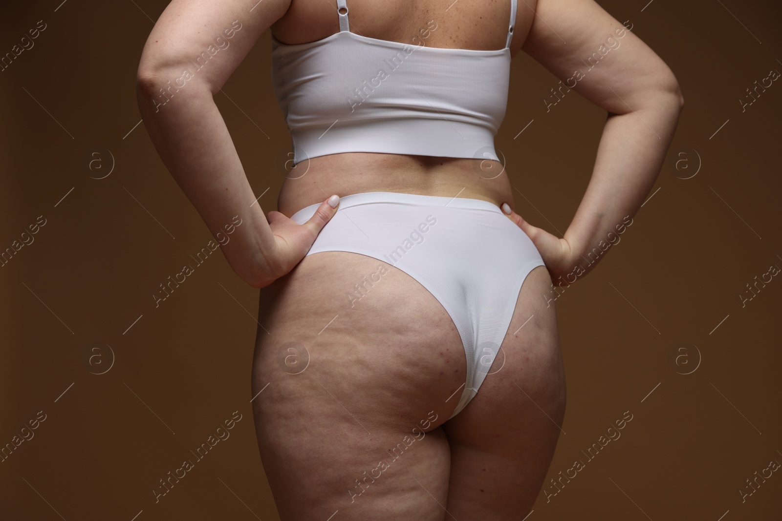 Photo of Woman with cellulite on brown background, closeup