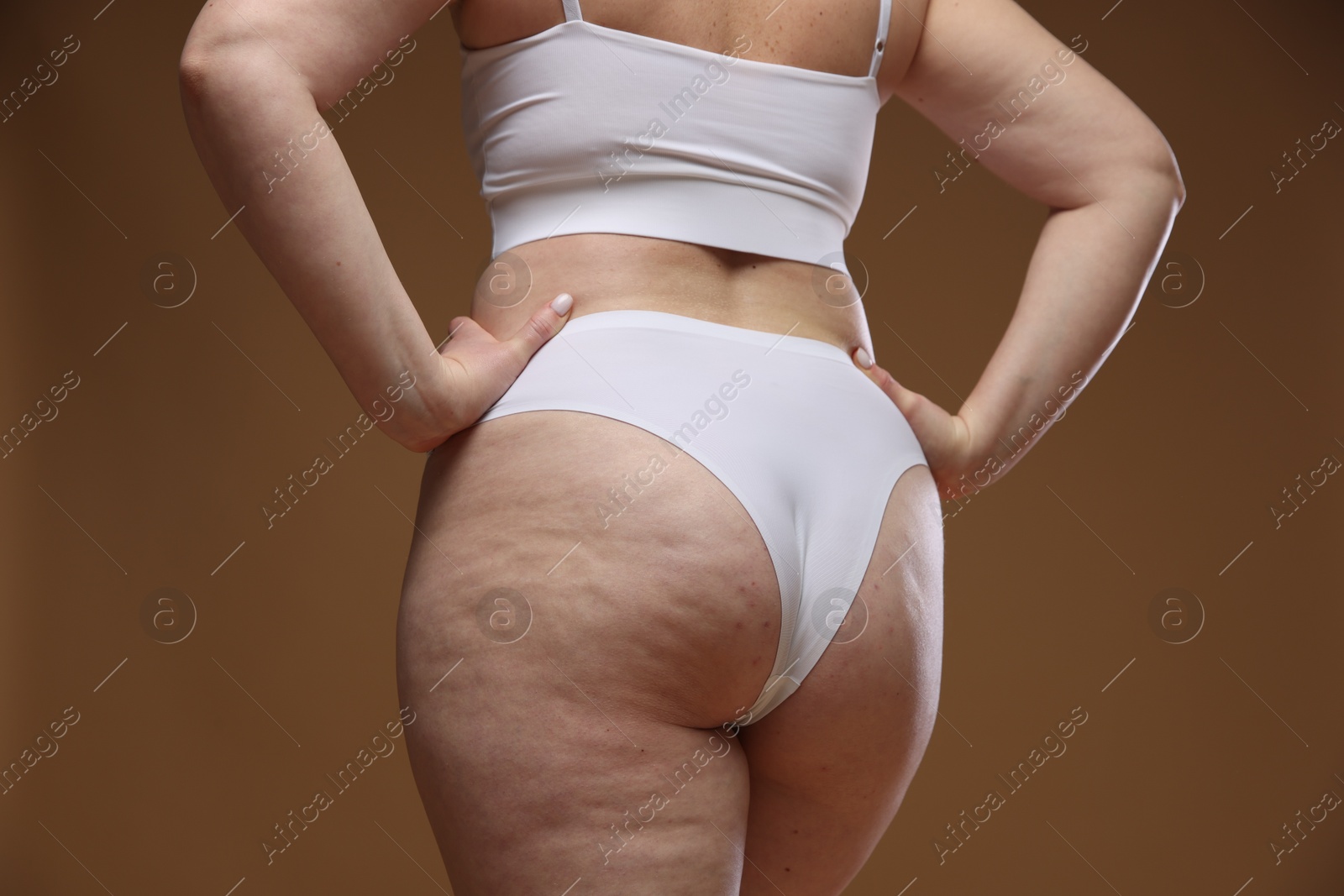 Photo of Woman with cellulite on brown background, closeup