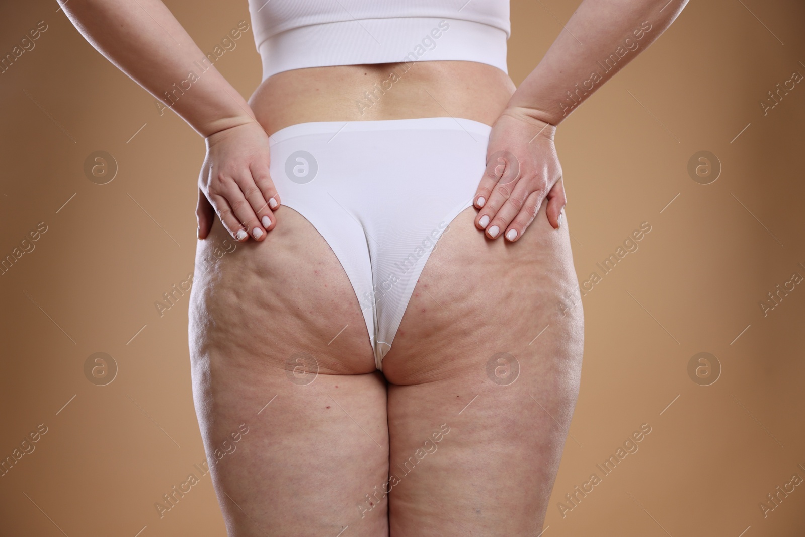 Photo of Woman with cellulite on light brown background, closeup