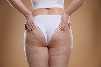 Photo of Woman with cellulite on light brown background, closeup