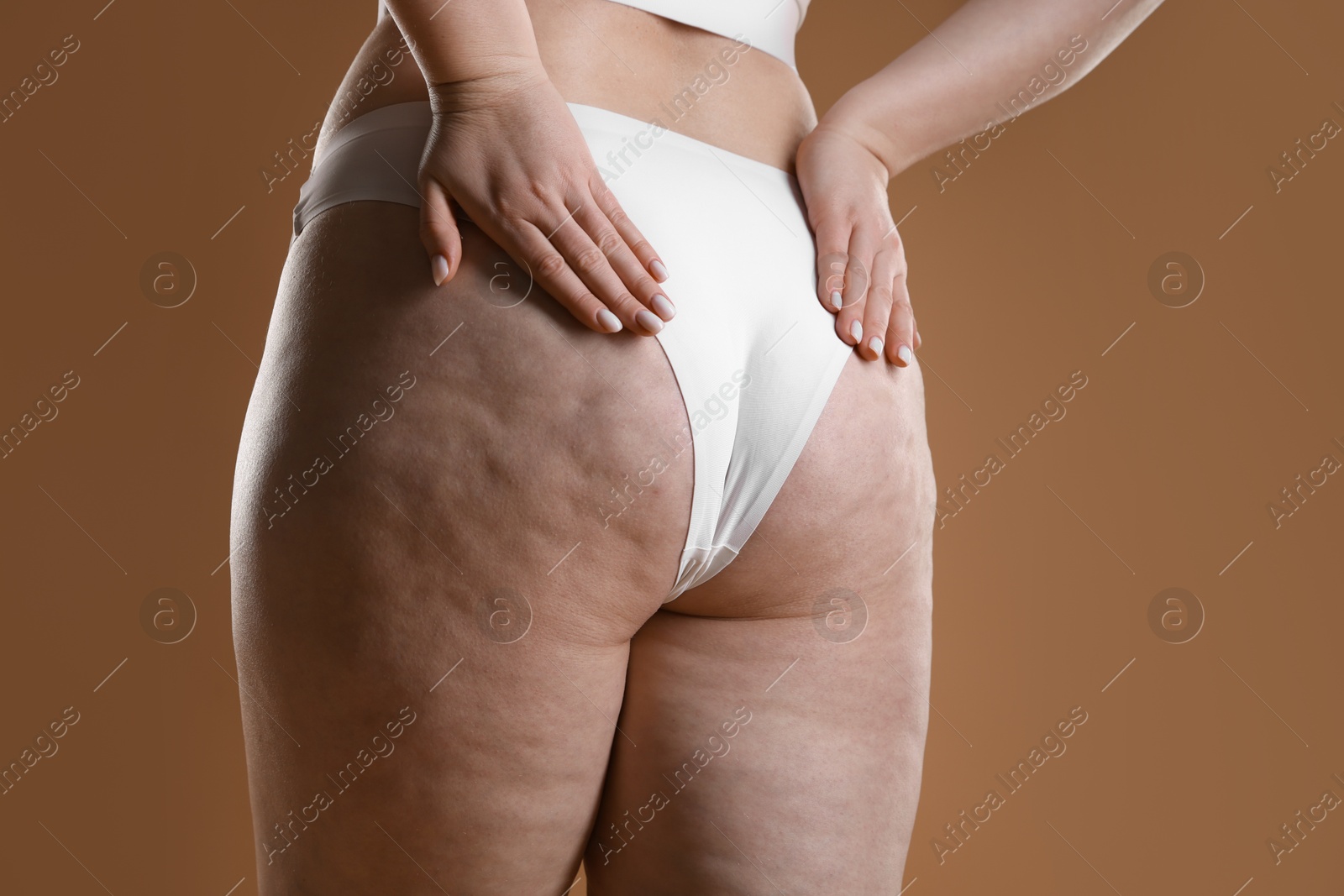 Photo of Woman with cellulite on light brown background, closeup