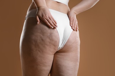 Photo of Woman with cellulite on light brown background, closeup