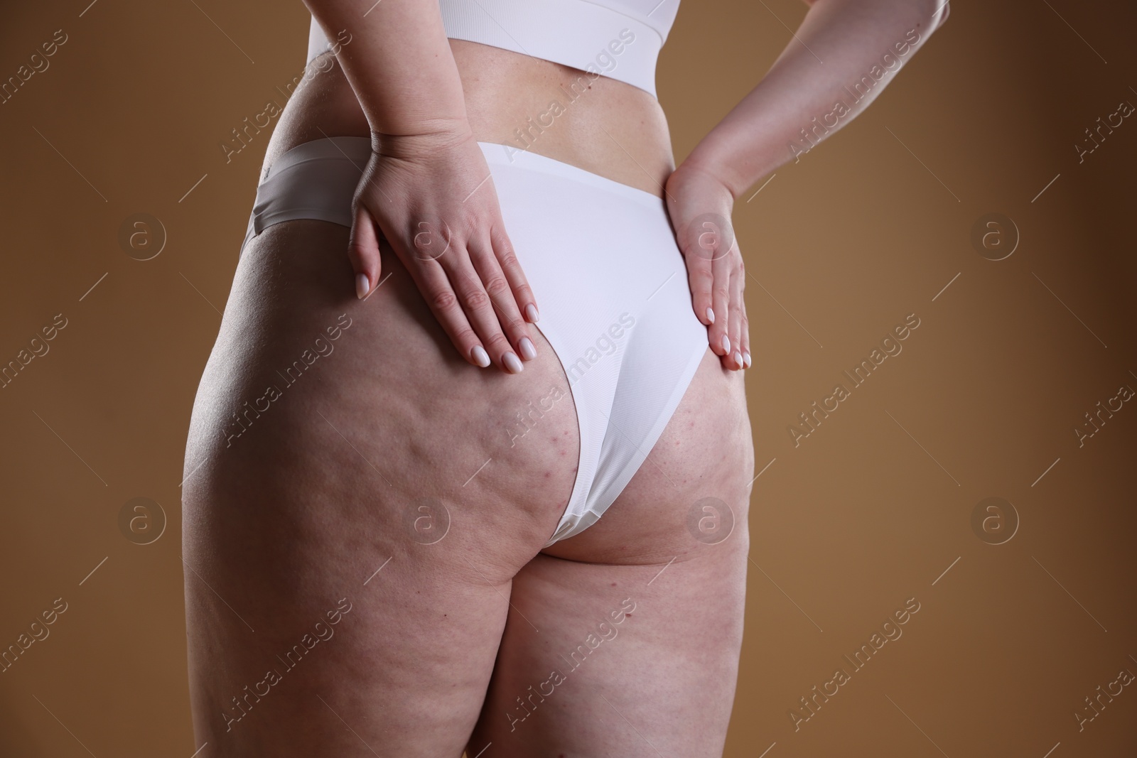 Photo of Woman with cellulite on light brown background, closeup