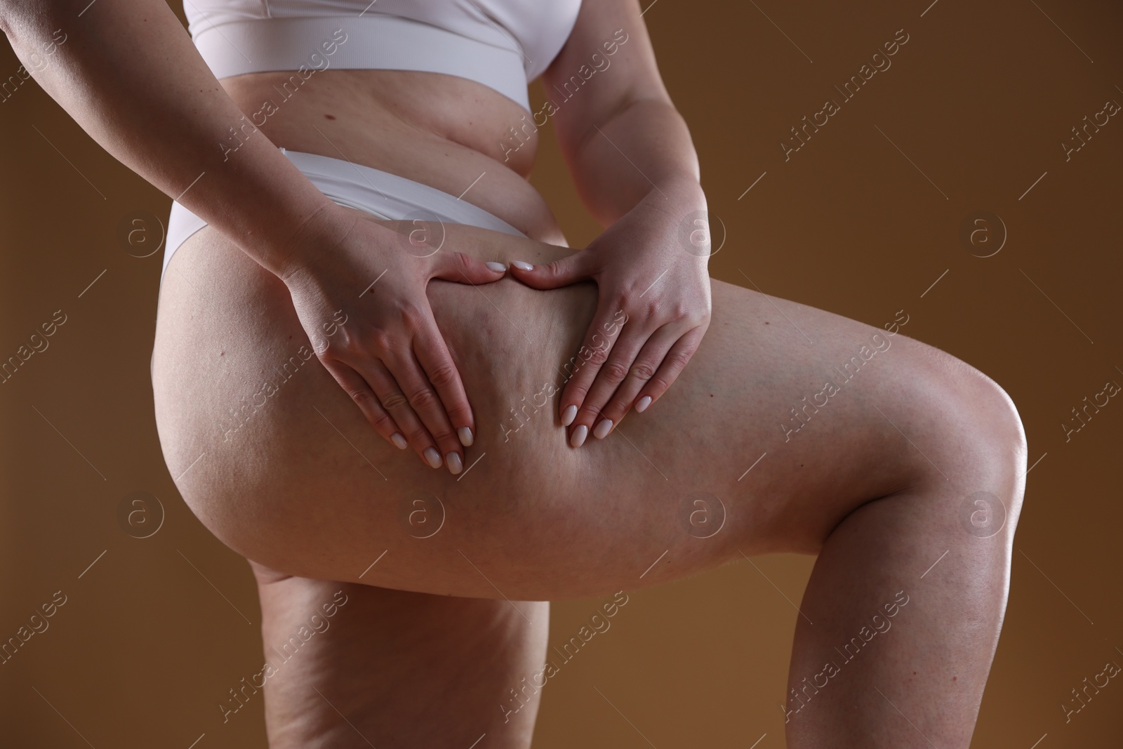 Photo of Woman with cellulite problem on brown background, closeup