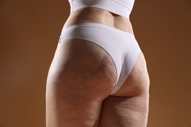 Photo of Woman with cellulite problem on brown background, closeup