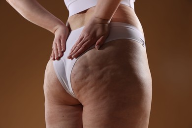 Photo of Woman with cellulite problem on brown background, closeup