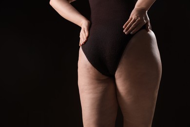 Photo of Woman with cellulite problem on black background, closeup. Space for text