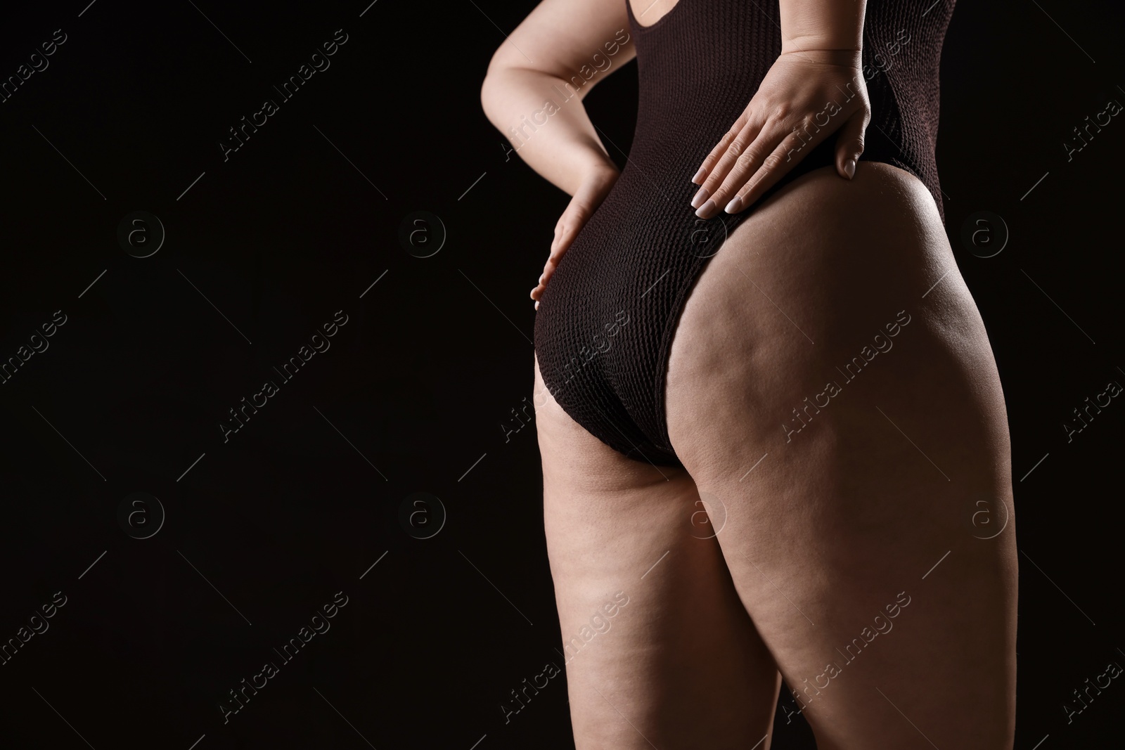 Photo of Woman with cellulite problem on black background, closeup. Space for text