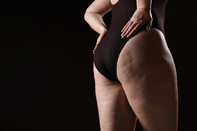 Photo of Woman with cellulite problem on black background, closeup. Space for text