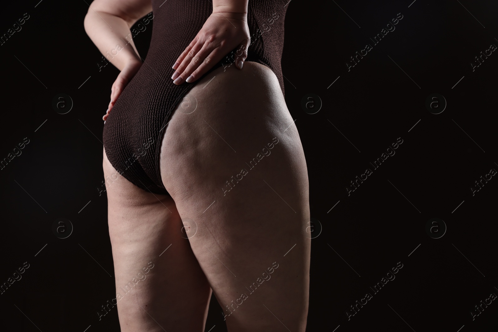 Photo of Woman with cellulite problem on black background, closeup. Space for text