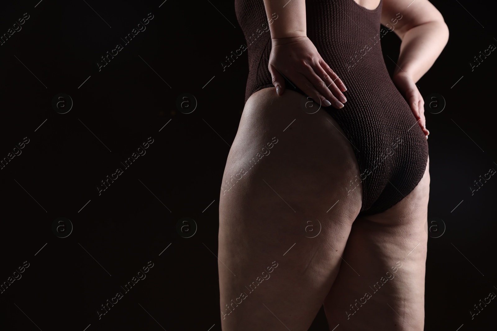 Photo of Woman with cellulite problem on black background, closeup. Space for text