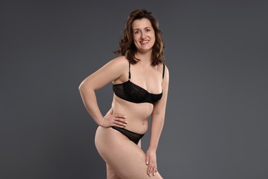 Photo of Beautiful woman in underwear on dark grey background. Cellulite problem