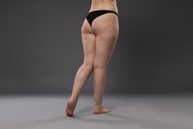 Photo of Woman with cellulite problem on grey background, closeup