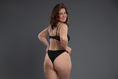 Photo of Beautiful woman in underwear on dark grey background. Cellulite problem