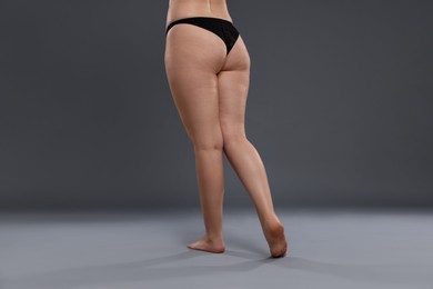 Photo of Woman with cellulite problem on grey background, closeup