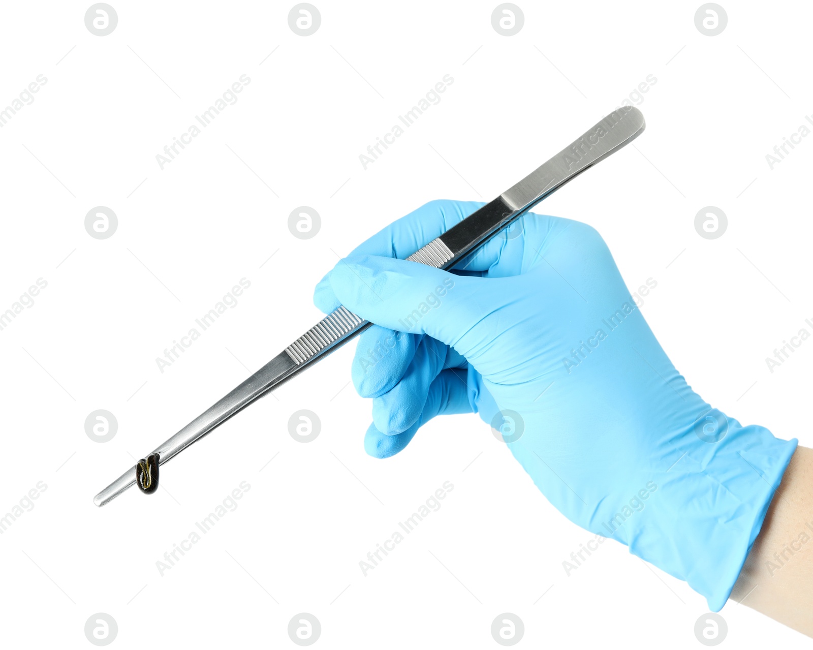 Photo of Doctor holding medicinal leech with tweezers on white background, closeup