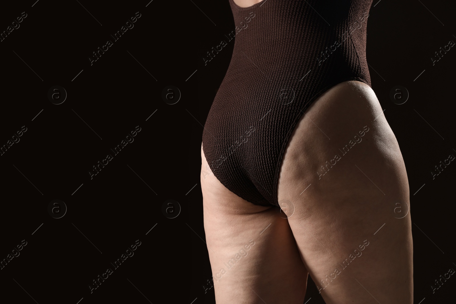 Photo of Woman with cellulite problem on black background, closeup. Space for text