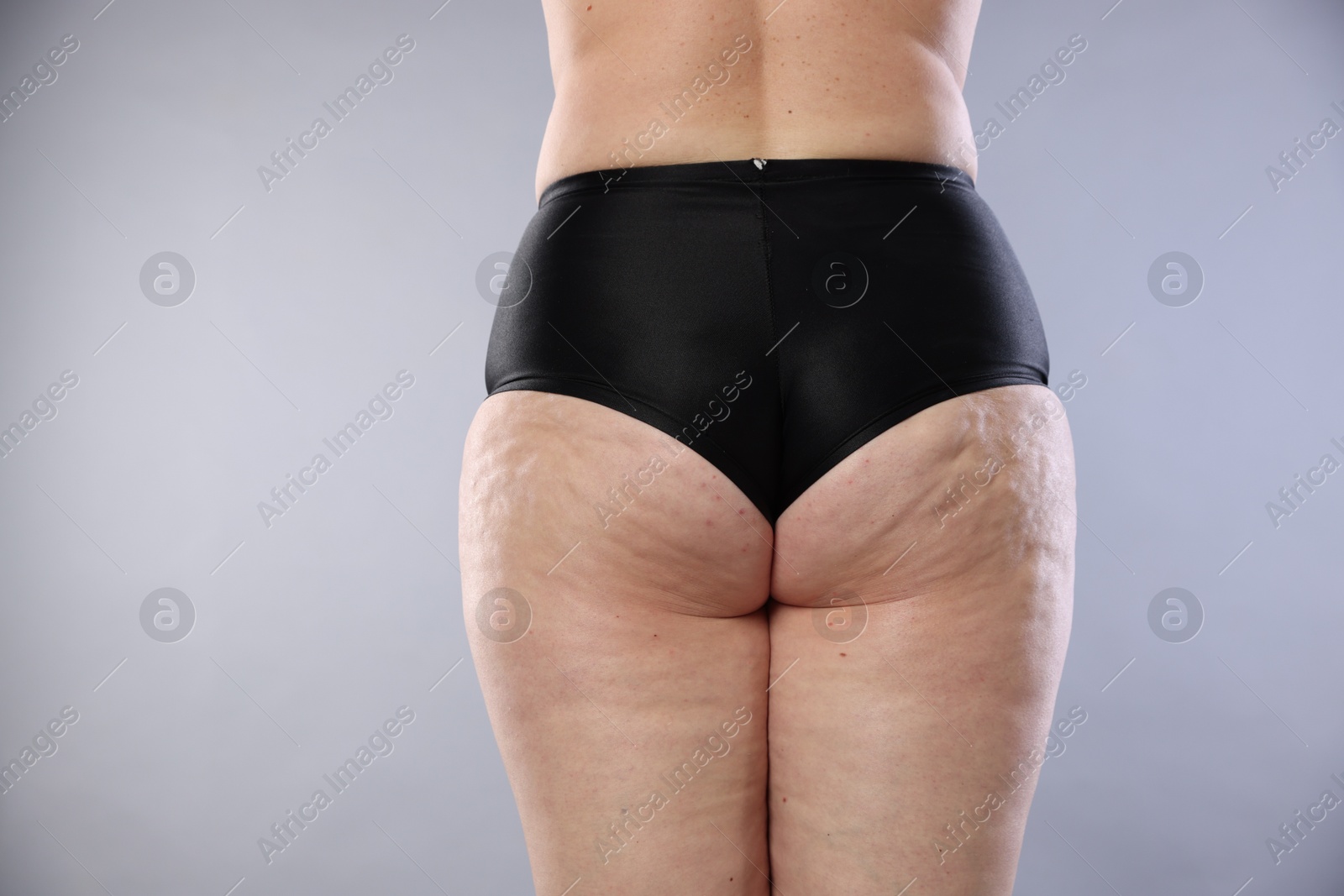 Photo of Woman with cellulite on light grey background, closeup. Space for text