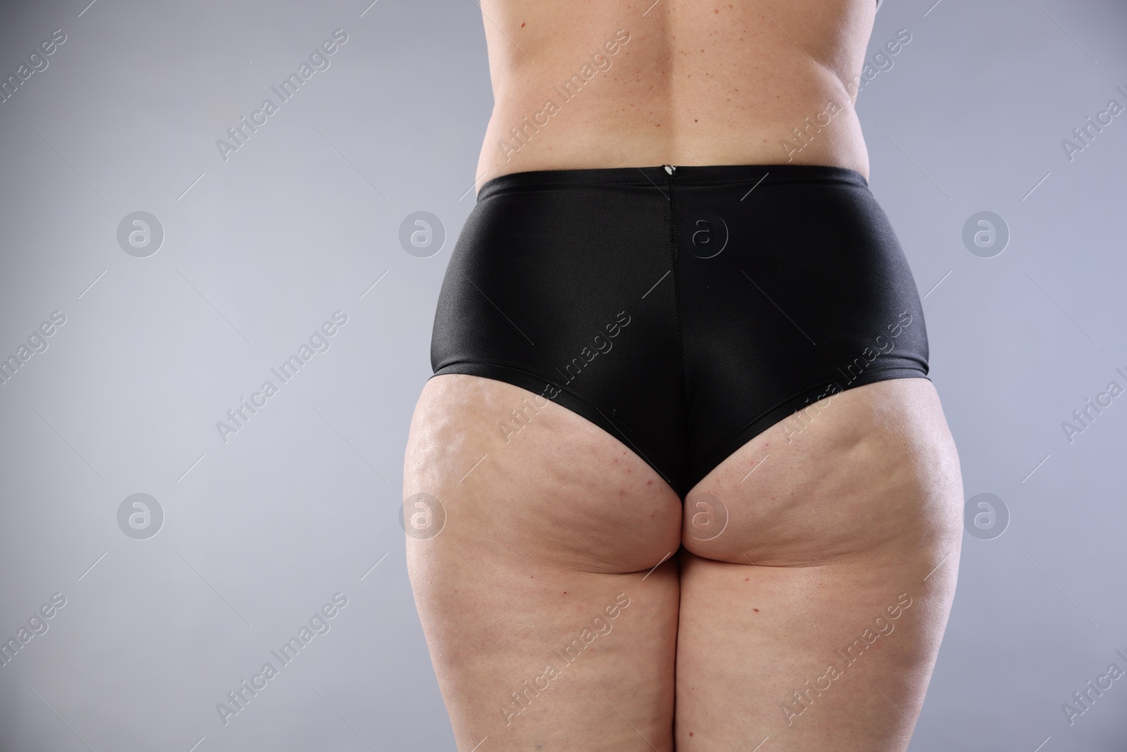 Photo of Woman with cellulite on light grey background, closeup. Space for text